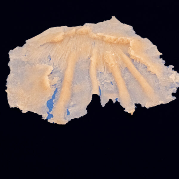 Silicone Prosthetic Top of Hand Injury Degloving