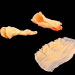 Silicone Prosthetic Finger Degloving Pack