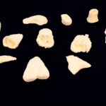 Assorted Open Fracture Prosthetic Bone Pack