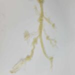 Silicone Prosthetic Varicose Vine